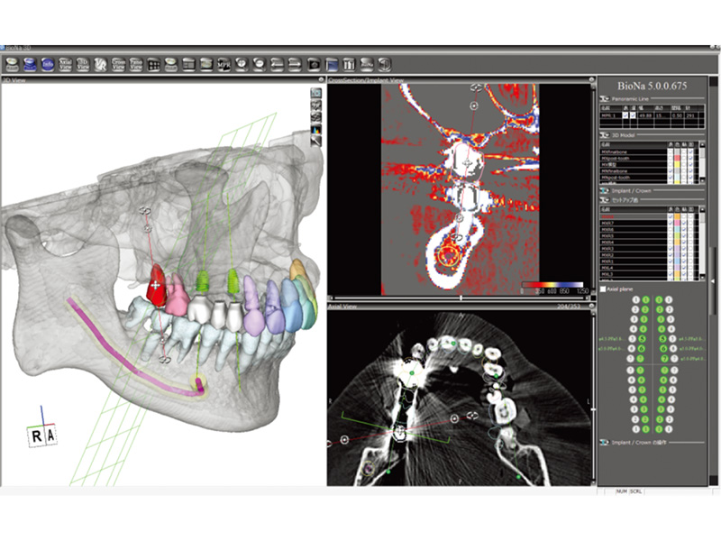 BioNa（ビオナ）