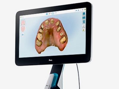 光学スキャン・シミュレーション